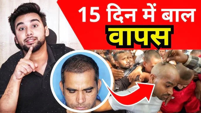 🌿 Jamalgota Ayurvedic Hair Growth Powder 🌿